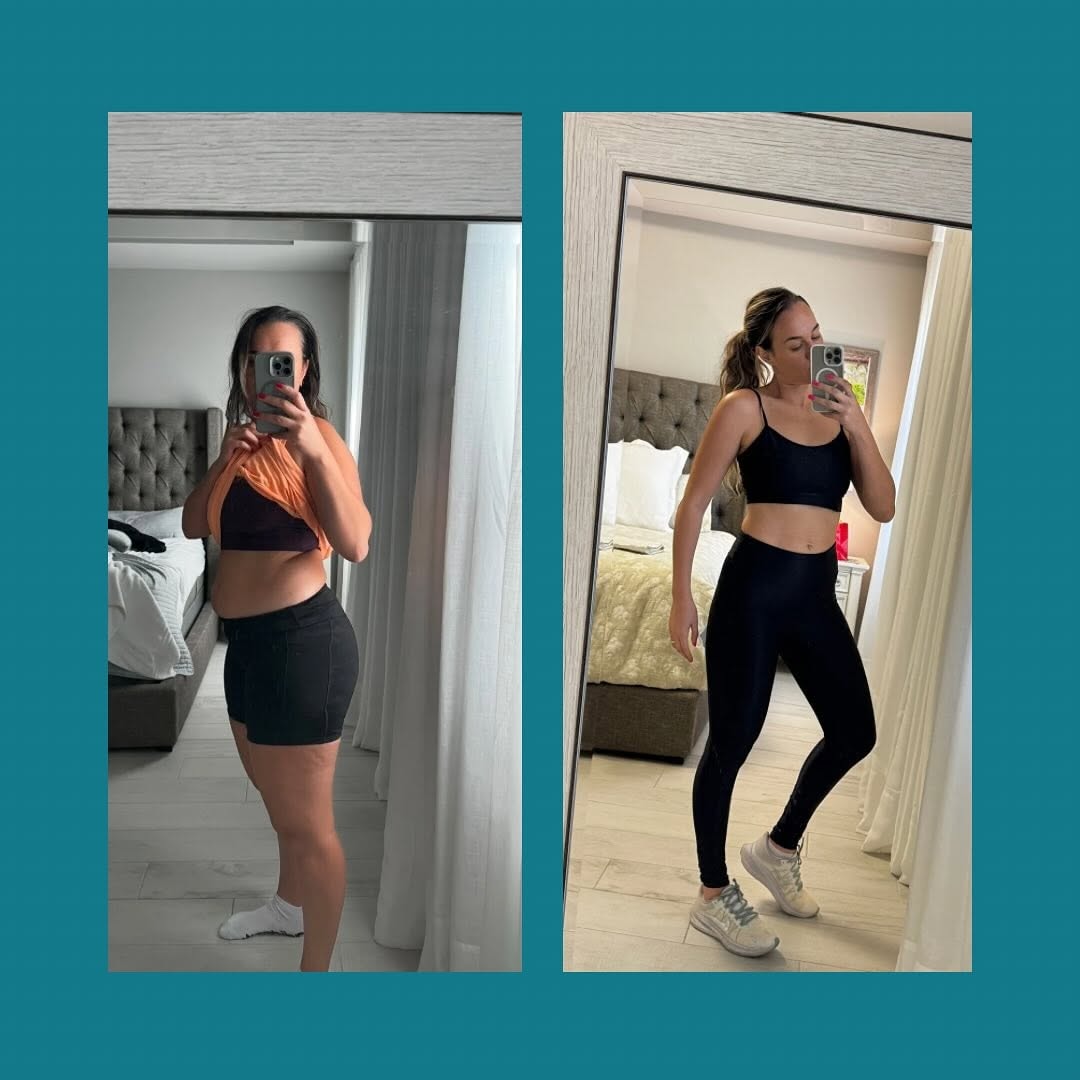 Patient before and after weight loss results at Synergy Medical Group